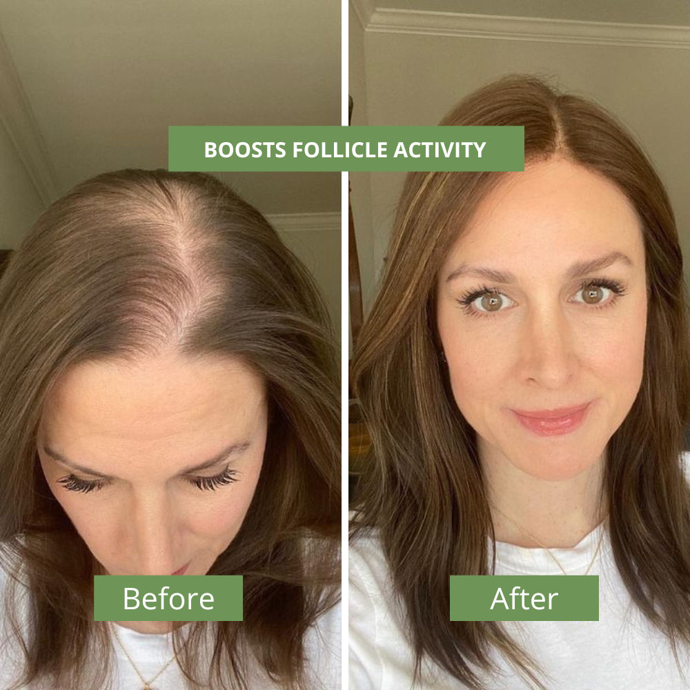 Hair Recovery Serum Advanced 2.0
