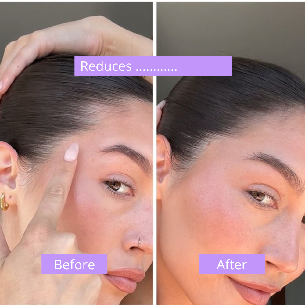 Hair Recovery Serum 2.0
