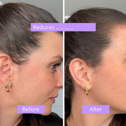 Hair Recovery Serum 2.0