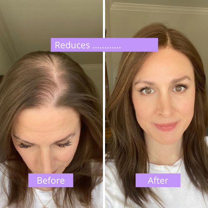 Hair Recovery Serum 2.0