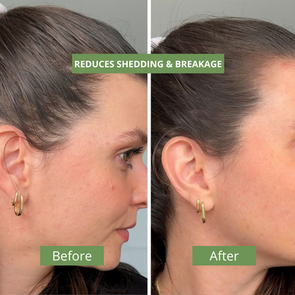 Hair Recovery Serum Advanced 2.0